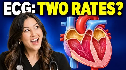 ECG Interpretation for ICU Nurses: Rate, Rhythm and QRS